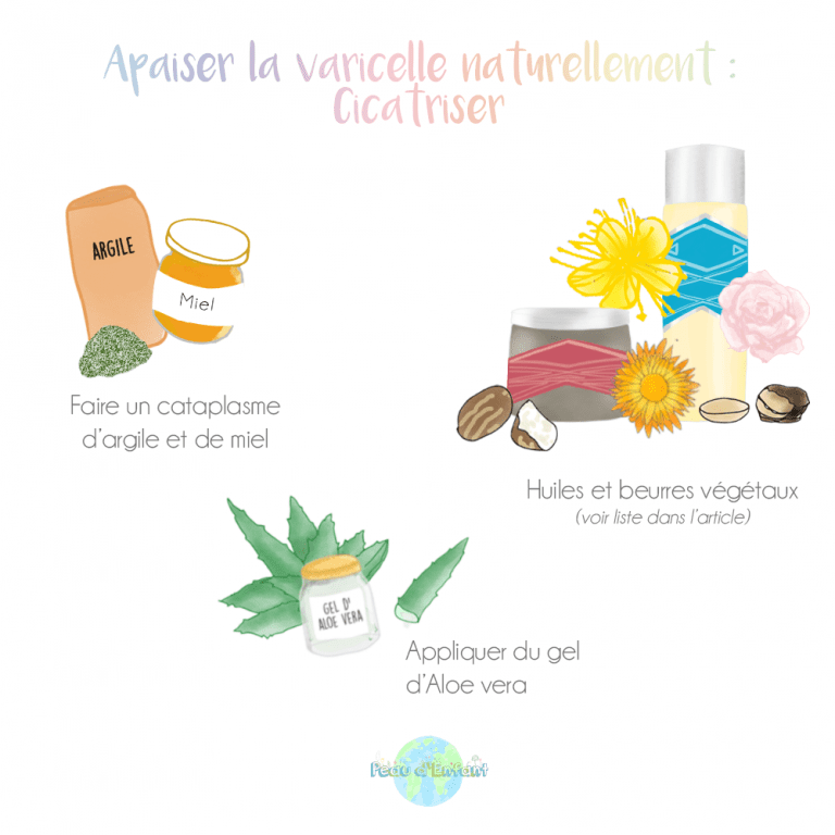 Apaiser la varicelle naturellement